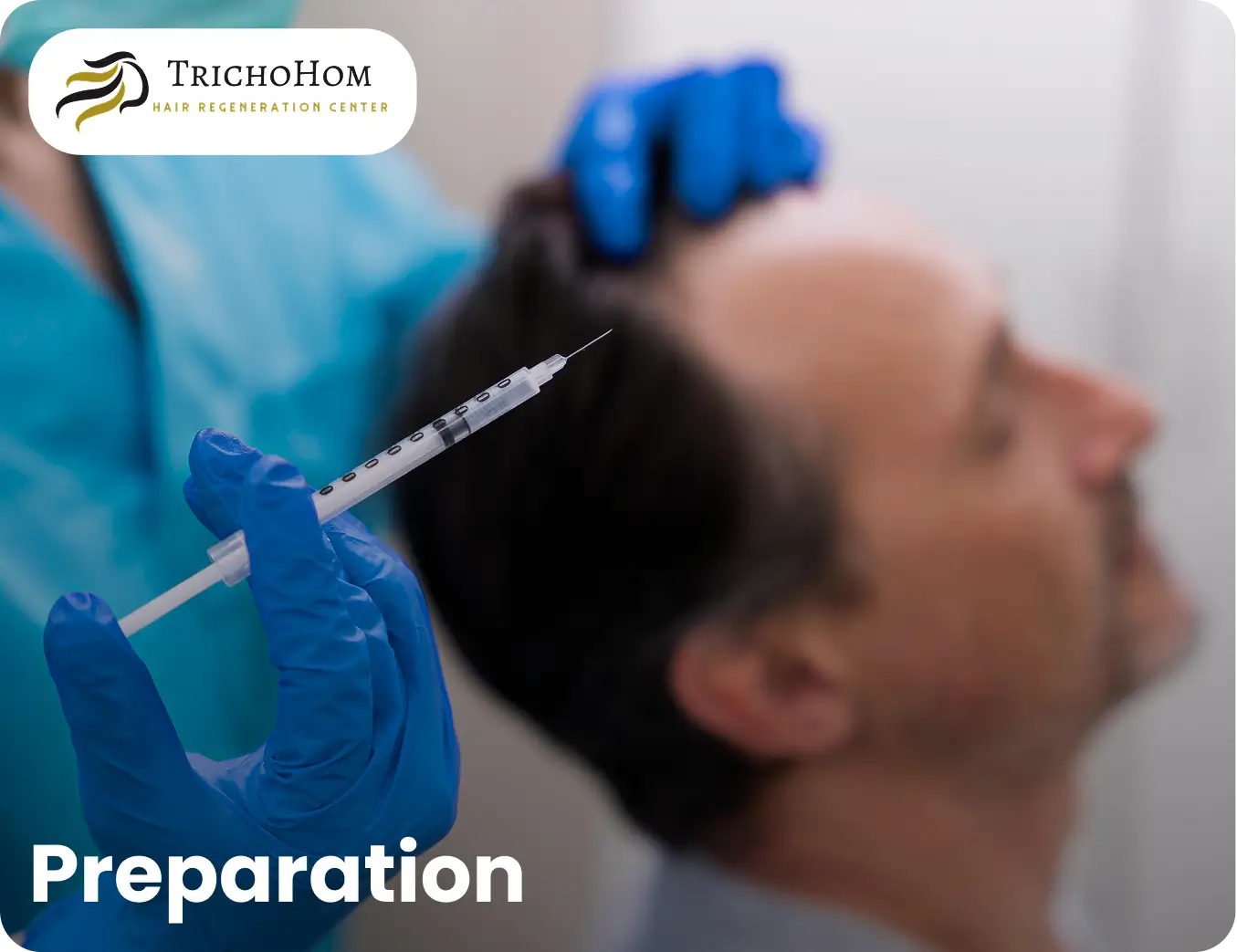 preparation