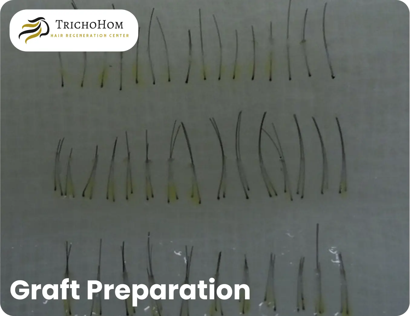 graft preparation