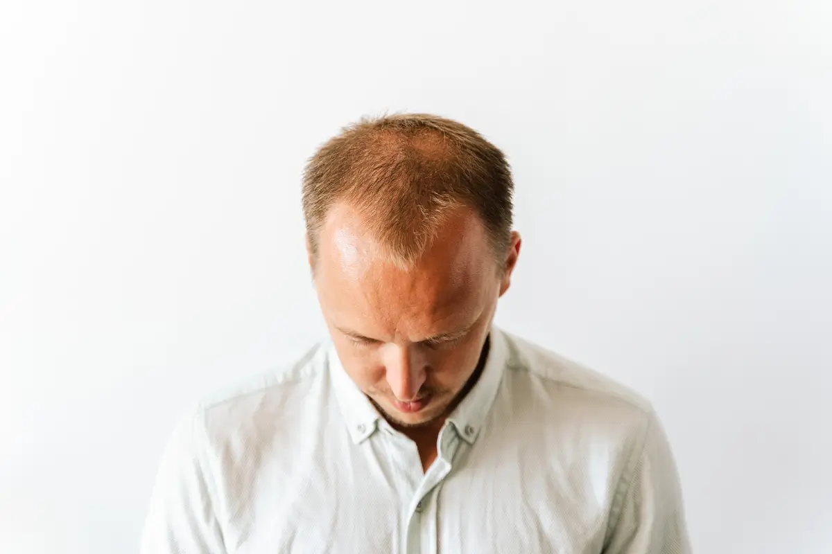 6 Reasons for Sudden Hair Loss