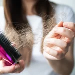 Top Causes of Hair fall Best Treatments, How to Prevent and Symptoms
