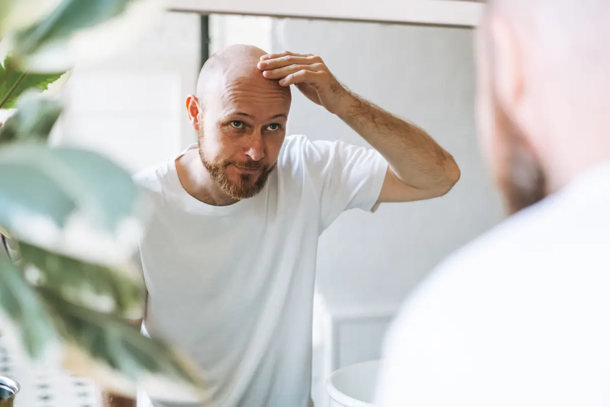 Can Change in Hormones Lead to Hair Loss