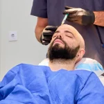 Comparison between hair transplant and hair implant procedures