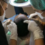 Hair Transplant Surgeon in Ahmedabad
