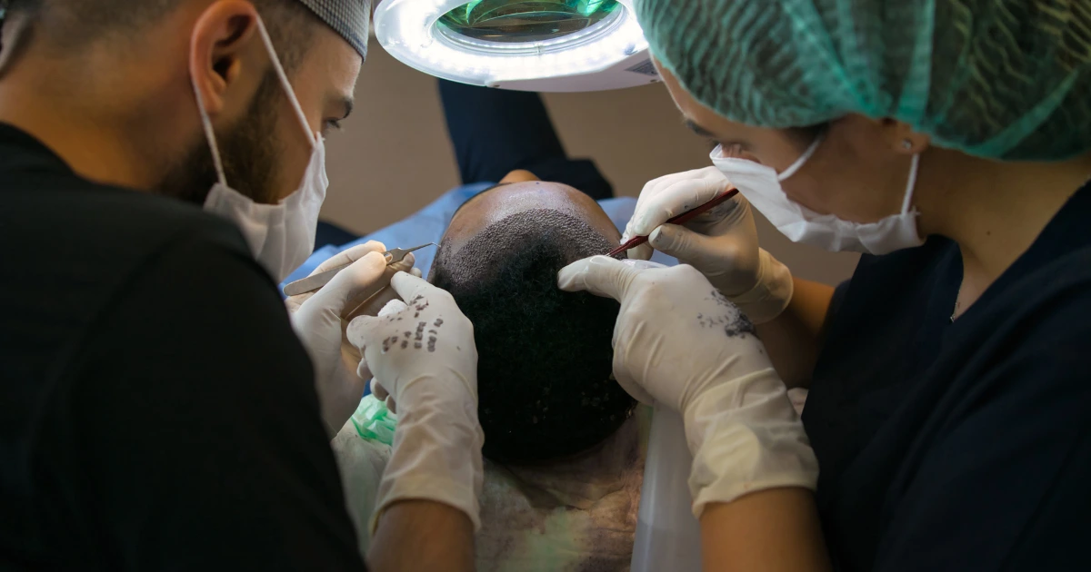 Hair Transplant Surgeon in Ahmedabad