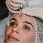 Botox treatment for anti-aging at Trichohom