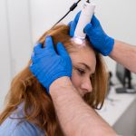 Understanding and Treating Alopecia Areata