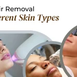 Laser Hair Removal for All Skin Types: Safe & Effective