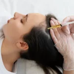 5 Myths About Hair Treatments in Ahmedabad You Should Stop Believing